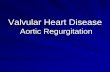 Valvular Heart Disease Aortic Regurgitation Regurgitation: Symptoms Dyspnea, orthopnea, PND Chest pain. –Nocturnal angina >> exertional angina –( diastolic aortic pressure and