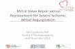 Mitral Valve Repair versus Replacement for Severe Ischemic ... 2013/Acker_Mitral... · Mitral Valve Repair versus Replacement for Severe Ischemic Mitral Regurgitation Michael Acker,