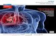 Fast-tracking lung cancer  · PDF fileFast-tracking lung cancer diagnosis The successful treatment of lung ... • NOCRI Microsite:   • NOCRI E-Mail: nocri@nihr.ac.uk