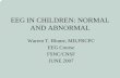 EEG IN CHILDREN: NORMAL AND  · PDF fileeeg in children: normal and abnormal warren t. blume, md,frcpc. eeg course. fsnc/cnsf. june 2007