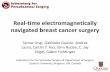 Real-time electromagnetically navigated breast cancer …research.cs.queensu.ca/home/cisc330/Lectures/Breast/Breast-Surgery... · • Breast cancer kills more women than any other
