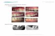 Esthetic Periodontal Plastic Surgery - ProSites, Inc.c2-preview.prosites.com/153784/wy/docs/photo gallery … ·  · 2014-01-18Periodontitis Implants ... Microsoft Word - marketing