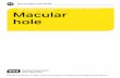 Macular Hole - RNIB - Supporting people with sight loss - hole.docx · Web viewA macular hole is a very different eye condition from macular degeneration even though they both affect