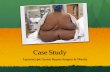 Case Study · Case Study Laparoscopic Gastric Bypass Surgery & Obesity . Pathology Associated with Obesity ... Cholelithiasis