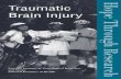 Traumatic Brain Injury - Catalog home What is a Traumatic Brain Injury? TBI, also called acquired brain injury or simply head injury, occurs when a sudden trauma causes damage to the