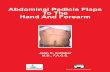 Abdominal Pedicle Flaps To The Hand And Forearm · Abdominal Pedicle Flaps To The Hand And Forearm Global-HELP Publications. Chapter Eight: ... Our examination revealed heavy scarring