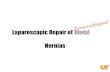 Laparoscopic Repair of Hiatal Hernias · Conclusions • Laparoscopic repair of paraesophageal hernia can be performed safely and with good results • Operative experience and attention