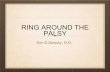 RING AROUND THE PALSY - MercyHealthSystem.org · • to determine if it is comitant or non comitant . ... Strabismus surgery if it has lasted more than 6 months . Follow up Re- examine