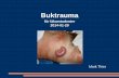 Levertransplantation efter trauma - med.lu.se · Esofagus-papill Th 5-9 = mamiller till navel Tunntarm-transversum Th 9-11 = navel till ljumskar ... Diafragma - ruptur Duodenum -