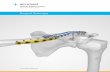 Acu-Sinch® Repair System - Acumed · The Acu-Sinch Repair System is intended to be used in conjunction with the Clavicle Plating System to provide fixation during the healing of