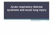 Acute respiratory distress syndrome and acute lung … lectures/Anaesthesia/ARDS.pdf · Acute respiratory distress syndrome Adult hyaline membrane disease ... Echocardiography –