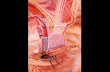 Funktionelle Anatomie des Lidappaarates - Augenklinikaugenklinik.uk-wuerzburg.de/fileadmin/uk/augenklinik/Dokumente/... · yHordeolum (akute Meibom Entz.) yChalazion (Chron. Lipogranulom)