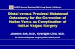 Distal versus Proximal Metatarsal Osteotomy for the ...€¦ · Distal versus Proximal Metatarsal Osteotomy for the Correction of Hallux Varus as Complication of Hallux Valgus Surgery