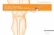 KNEE ACUFEX PINPOINT Anatomic ACL Guide System · The ACUFEX PINPOINT Anatomic ACL Guide System helps ensure anatomic placement and acts as a template to allow the surgeon to visualize