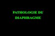 PATHOLOGIE DU DIAPHRAGME - onclepaul.netonclepaul.net/wp-content/uploads/2011/07/D-C-thorax-diaphragme... · HERNIE de Morgagni • 2 à 3 % hernies diaphragmatiques • adulte •