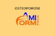 Osteoporose - BIENVENUE SUR LE SITE DE …€¦ · –Para thyroïde ; thyroïde , ... •Clinique - signes d’appel ; ATCD ... cas particulier de l’ostéoporose induite par les