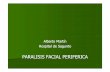 PARÁLISIS FACIAL PERIFÉRICA - dep4.san.gva.es · PARALISIS FACIAL PERIFERICA. ... En pacientes con parálisis facial de Bell, el tratamiento temprano con prednisolona incrementa