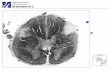 UMass Medical School Mind Brain Behavior 1 … · Transverse SectionMid Sagittal. Brainstem B-1. UMass Medical School Mind Brain Behavior 1. Note: Brainstem B shows marked degeneration