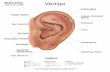 downloads.miridiatech.comdownloads.miridiatech.com/auriculo/Vertigo.pdf · ACUPUNCTURE TECHNOLOGY POINT ZERO Ear (Inner).E Occiput THALAMUS POINT Forehead MASTER SENSORIAL Ear (Inner).C