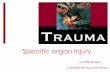 Biomechanic of injury - Srinakharinwirot Universitymed.swu.ac.th/surgery/images/SAR54/trauma .pdf · Biomechanic of injury Blunt trauma ... Most common solid organ injury in blunt