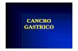 3 Cancro gastrico - homepage — Unife · Stadio II T1 N2 M0 T2 N0 M0 T1 N1 M0 Stadio I T1 N0 M0 Stadio 0 Tis N0 M0. Terapia CHIRURGICA ... gastrodigiunale sec. Billroth II + Brown