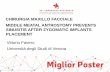 CHIRURGIA MAXILLO FACCIALE MIDDLE MEATAL … · CHIRURGIA MAXILLO FACCIALE LONG-TERM OUTCOMES OF DENTAL IMPLANTS IN ONCOLOGIC PATIENTS RECONSTRUCTED WITH FIBULA FREE FLAPS Agnese