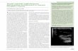 pęcherzyków zarodkowych w ciążach vesicles in multiple ... 2011_02 06.pdf · pęcherzyka jajnikowego. Piśmiennictwo zawiera opisy bliźniąt identycznych (3, 4), jednak dotychczas