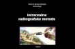 Intraoralne radiografske metode - Kosovskoj Mitrovici · Stomatološka radiografska tehnika • Intraoralne metode retroalveolarni, retrokoronarni, okluzalni, aksialni • Ekstraoralne