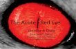 The Acute Red Eye - Auckland · The Acute Red Eye Jennifer P. Craig Associate Professor . Department of Ophthalmology . jp.craig@auckland.ac.nz