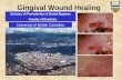 Gingival Wound Healing - UBC Dentistrytst-dentistry.sites.olt.ubc.ca/files/2014/10/WoundHealing... · Gingival Wound Healing Division of Periodontics & Dental Hygiene Faculty of Dentistry
