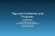 Figurate Erythemas and Purpuras - cdn.ymaws.com · •Dermatophytes (Tinea Pedis) •Fungal: Candida, Penicillium in blue cheese. •Viruses (e.g. poxvirus, EBV, varicella-zoster