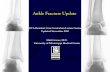 Ankle Fracture Update - ota.org Fractures.pdf · restoration of the ankle mortise and stable internal fixation, but… – Because the soft tissue complications are higher, increased