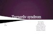 Turnerův syndrom - is.muni.cz · případě hygroma colli cysticum odlišit Downův a Patauův syndrom, ale také familiární nuchální cystický hygrom, který spontánně regreduje