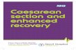 Caesarean section and enhanced recovery Dec 15 · The Enhanced Recovery Pathway has been developed to help you recover sooner after your caesarean section. The aim is to ... (placenta)