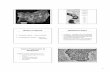 Modes of Spread Metastasis Steps - Columbia University · 1 Modes of Spread 1. Lymphatic spread – colon carcinoma 2. Hematogenous spread – renal cell carcinoma Tumor Progression