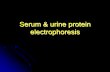 Serum & urine protein electrophoresis - Avera Health · Definitions Electrophoresis is a method of separating proteins based on their physical properties. Serum is placed on a specific