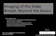 Imaging of the Male Breast-Beyond the Basics - tnrad.org · Objectives •Review the indications for male breast imaging •Review normal imaging appearance of the male breast •Illustrate