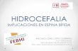 HIDROCEFALIA IMPLICACIONES EN ESPINA BÍFIDA - anpheb.esanpheb.es/wp-content/uploads/2016/06/PONENCIA-HIDROCEFALIA.pdf · hidrocefalia implicaciones en espina bÍfida antonio lÓpez