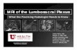 MRI of the Lumbosacral Plexus - skeletalrad.org - MRI of the Lumbosacral Plexus... · Be familiar with normal lumbosacral plexus anatomy, in addition to transitional lumbosacral nerve