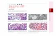 e14-HPIM18 e14 p0001-0011 - mhprofessionalresources.com · 14-3 CHAPTER e14 Atlas of Urinary Sediments and Renal Biopsies A B C Figure e14-7 Membranous glomerulopathy. Membranous