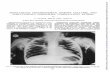 SPONTANEOUS PNEUMOTHORAX, MASSIVE COLLAPSE, …SUBCUTANEOUS EMPHYSEMA COMPLICATING ASTHMA BY C. ELAINE FIELD, M.D., M.R.C.P. E.M.S. Base Hospital, Hemel Hempstead(Great OrmondStreet)