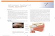 Arthroscopic Treatment of Biceps Tendinopathywosm.com/wp-content/uploads/2014/11/Arthroscopic-Biceps-Tenodesis-Dr... · Arthroscopic Treatment of 7 Biceps Tendinopathy Multiple anatomic