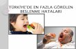 TÜRKİYE’DE EN FAZLA GÖRÜLEN BESLENME …gastronomi-mutfaksanatlari.com/FileUpload/ks241201/File/...Türkiye’de, enerji ve besin ögeleri yönünden beslenme durumu incelendiğinde,