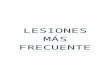 LESIONES - Cursos de Masaje en Castellón y Valencia · Web viewDesequilibrio muscular entre Adductores y Recto Anterior del Abdomen. Déficit de movilidad en la articulación coxo-femoral
