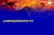 LYMPHADENOPATHY - Mans · 2016-12-26 · CAUSES OF LYMPHADENOPATHY l LOCALIZED ... Lymph Node Examination Inspection:-lymphedema - surgical scars from cancer excision - obvious masses