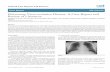 Pulmonary Veno-occlusive Disease: A Case Report and Review ... · Pulmonary Veno-occlusive Disease: A Case Report and Review of Literature Ahmad 1El-Gammal 1*, Sara Alsudairi, Rana