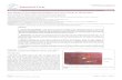 iver Journal of Liver - Longdom · The Study of Levofloxacin Effects on Liver Tissue in Wistar Rat Nazila Vahidi-eyrisofla3*, Mehdi Ahmadifar 1,2, Ali-Mohammad Eini4 and Arsalan Kalami