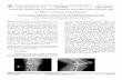 Automatic Classification of Anterio-Posterior and Lateral Views of … · 2016-04-23 · template images in each category are then used to match with the extracted descriptors of