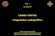 CARIES DENTAL - Diagnóstico radiográfico · 2019-04-21 · DIAGNÓSTICO RADIOLÓGICO DE LA CARIES - Caries proximal de esmalte - Cuando la lesión afecta a todo el espesor del esmalte,