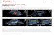 Ultrasound Clinical Case Study Liver Cirrhosis · Ultrasound Clinical Case Study Liver Cirrhosis ... Gallbladder wall size was normal at 2.2mm. The heterogeneity of the liver echotexture